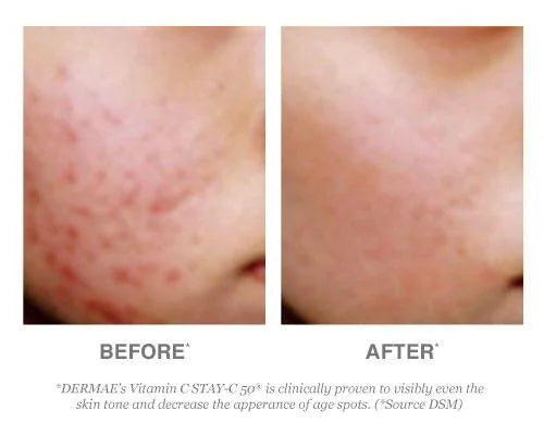 Derma E Vitamin C Concentrated Serum with Hyaluronic Acid